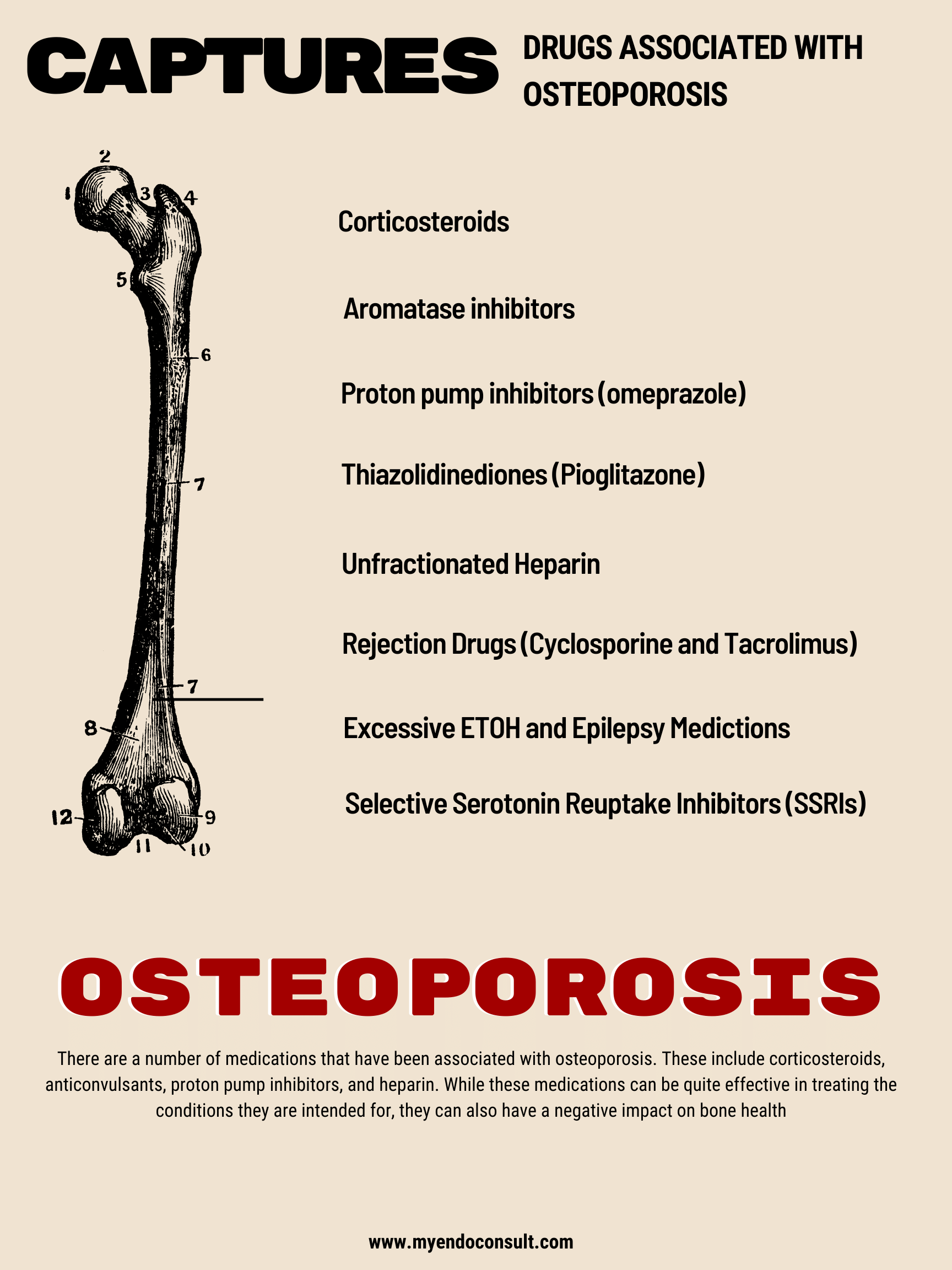 Mnemonic for drugs causing osteoporosis My Endo Consult