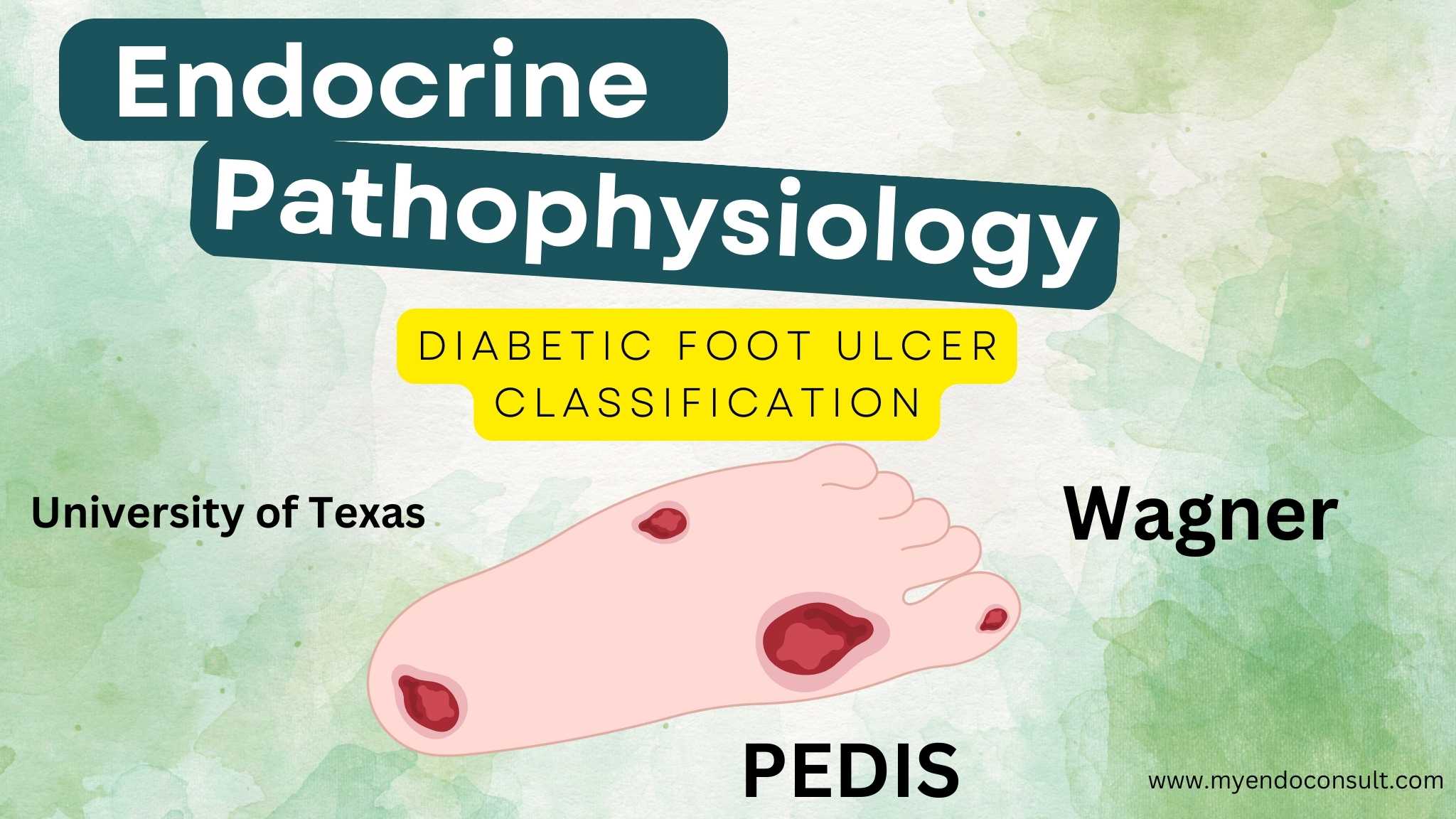 Diabetic Foot Examination My Endo Consult